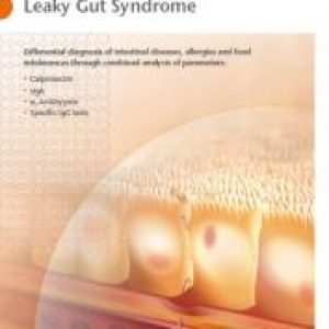 leaky-gut-syndrome-4p