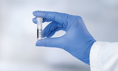 2025-12_ausdx-gerate-fur-mini-launch5