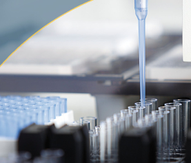 Laboratory 4.0: Hoe automatisering de diagnostiek verbetert