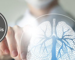 Neue Generation an Tuberkulose-Diagnostika von R-Biopharm