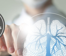 Neue Generation an Tuberkulose-Diagnostika von R-Biopharm